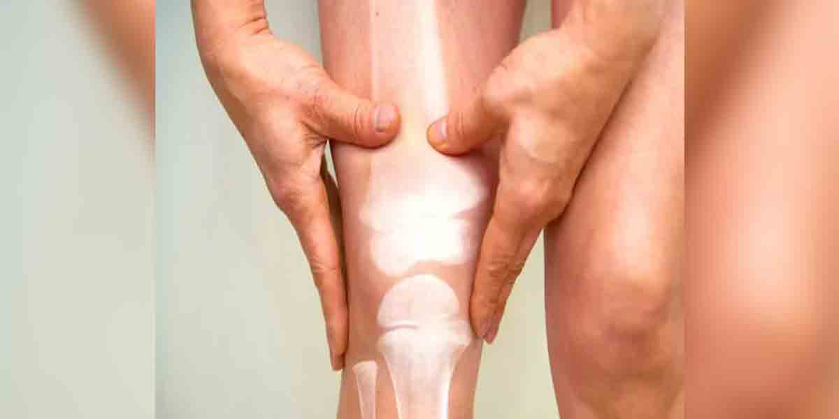 The Rarity That Is Sarcoma Cancer  and Why It’s Difficult to Diagnose